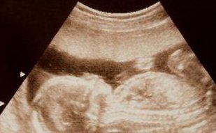 2026年在淄博去金门金厚生医院做试管的费用贵吗？费用明细介绍