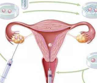 死精率80%的男性可以在阜新市做三代试管吗？公开2026做三代试管条件